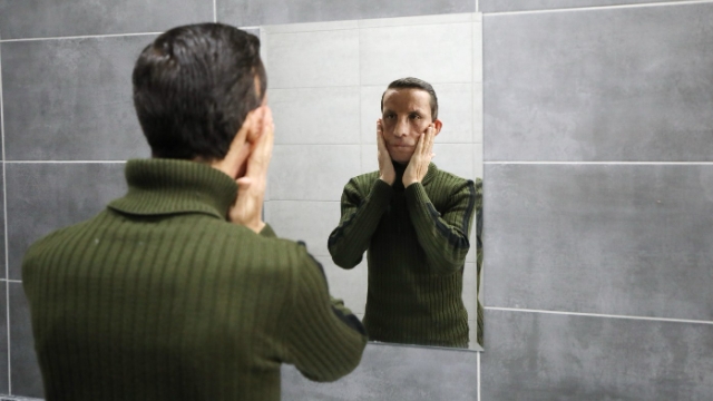 Yüzünü aldığı kişinin yaşına geldi